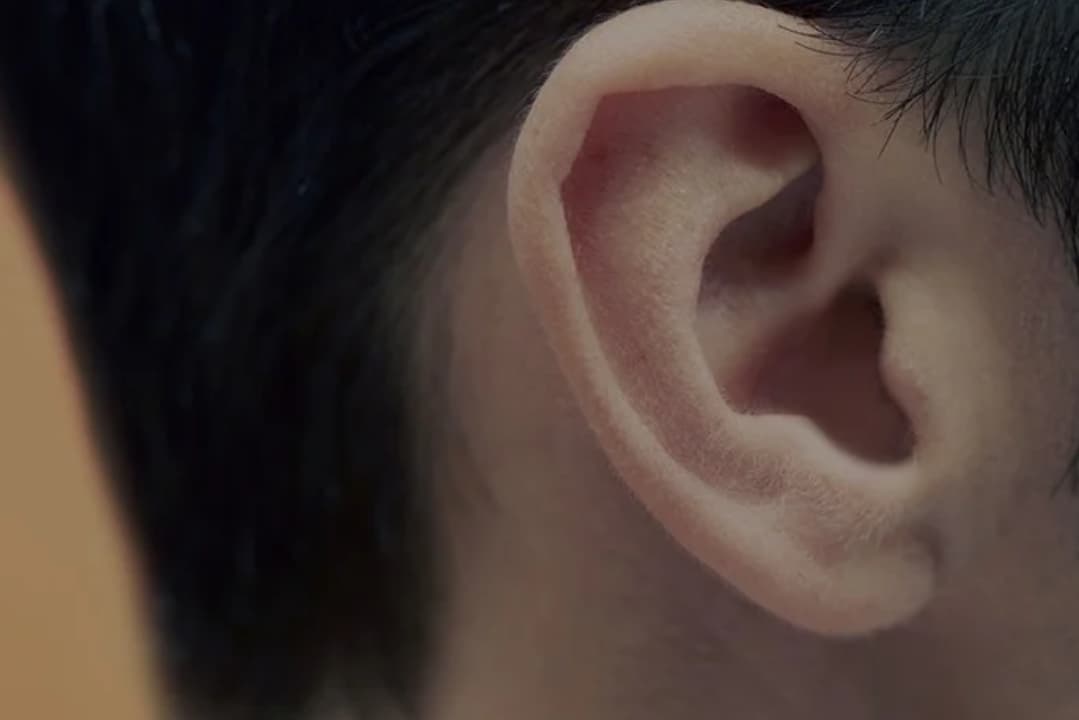 Ear Reconstruction Surgery