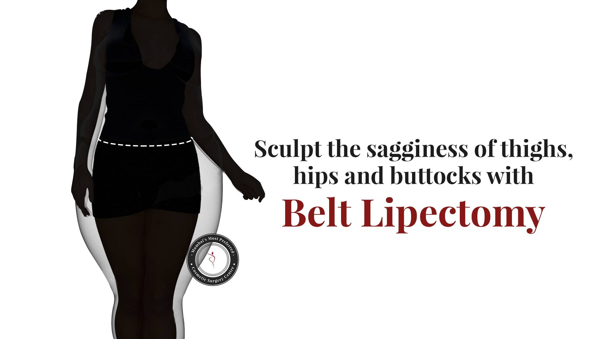 Belt Lipectomy Procedure