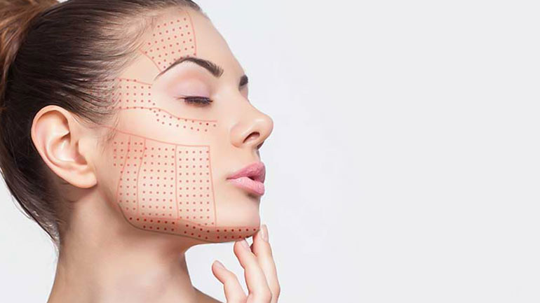 HIFU: Instant, Pain-free Skin Tightening