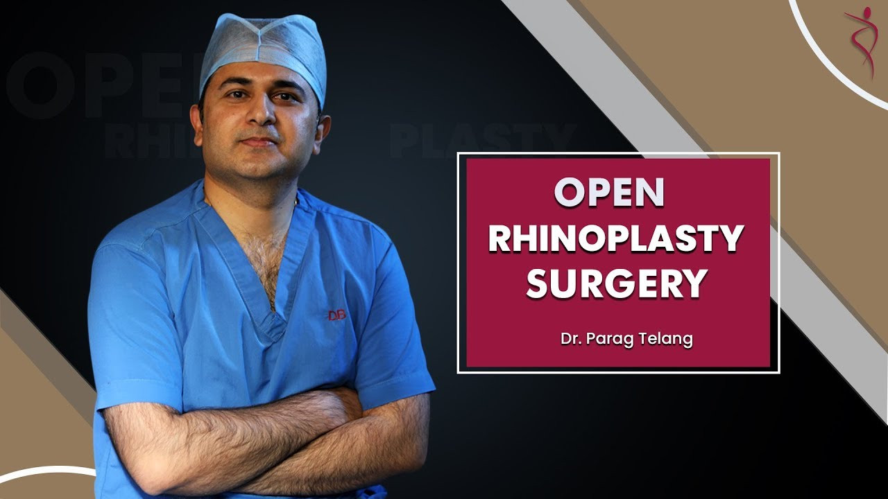 Open Rhinoplasty Surgery