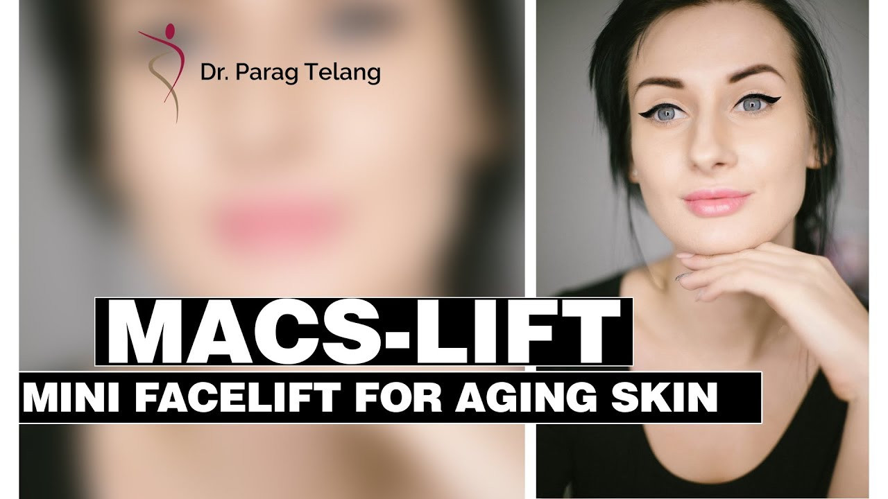 MACS-LIFT: Mini Facelift for Aging Skin!