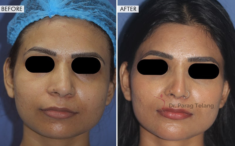 Facial Aesthetic Surgeries