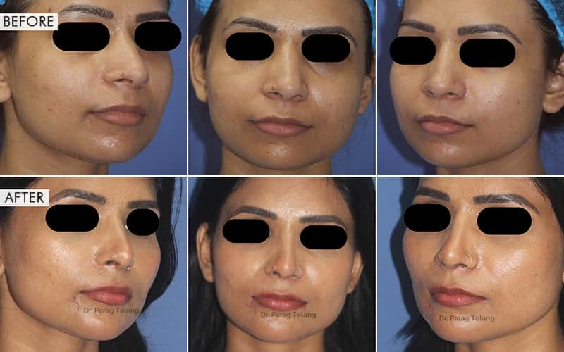 Facial Aesthetic Surgeries