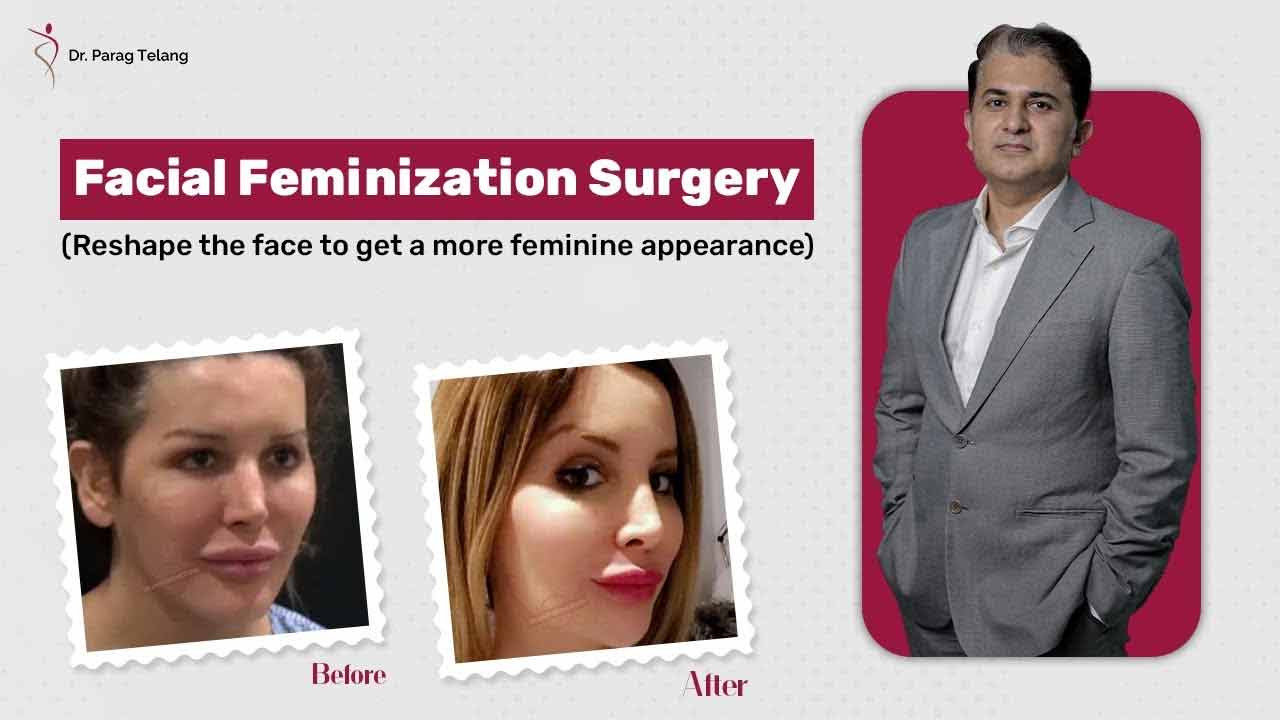 Lower Face Feminisation Surgery | FFS Surgery at Designer Bodyz