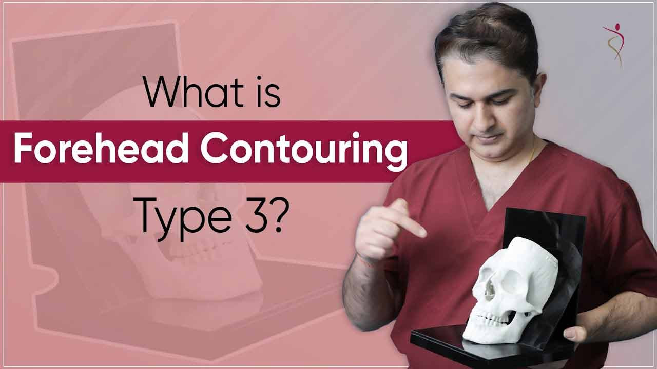 Type 3 Forehead Reconstruction | Forehead Contouring