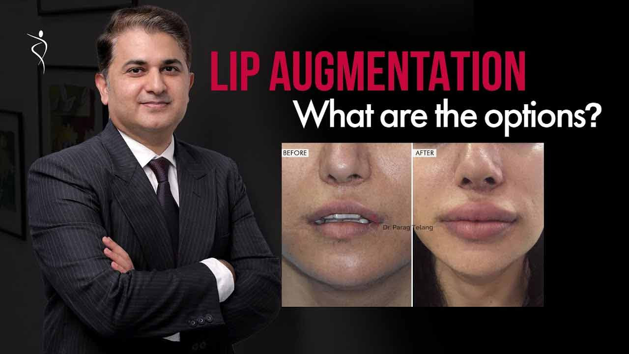 What are Lip Enhancement Treatment options? | Lip Fillers Treatment