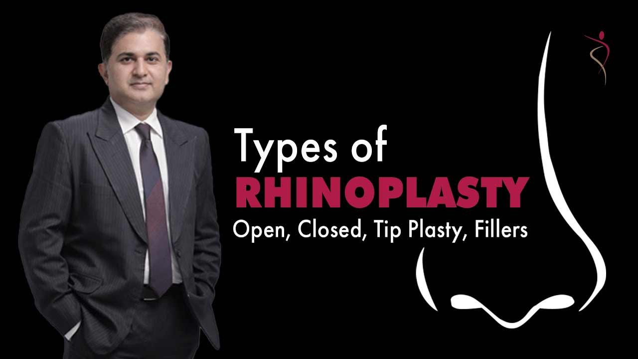 Different Types of Rhinoplasty or Nose Job