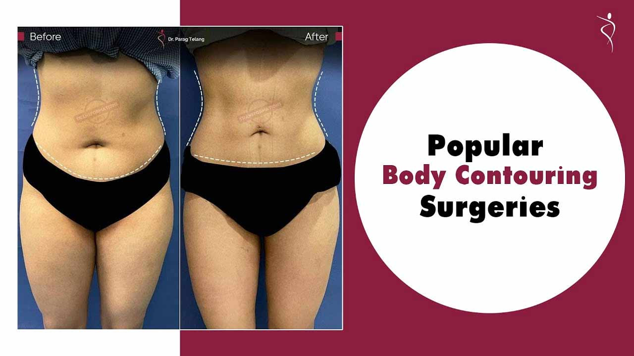 Get your dream body shape with Body Contouring surgeries