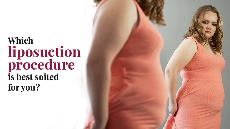 Which liposuction procedure is best suited for you?