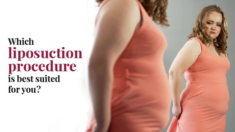 Liposuction procedure