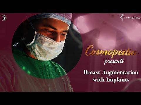 Enhance Breas-t Shape with Breas-t Augmentation